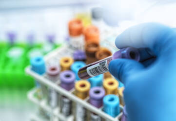 Medizintechniker, der menschliche Proben für medizinische Tests im Labor  vorbereitet, lizenzfreies Stockfoto